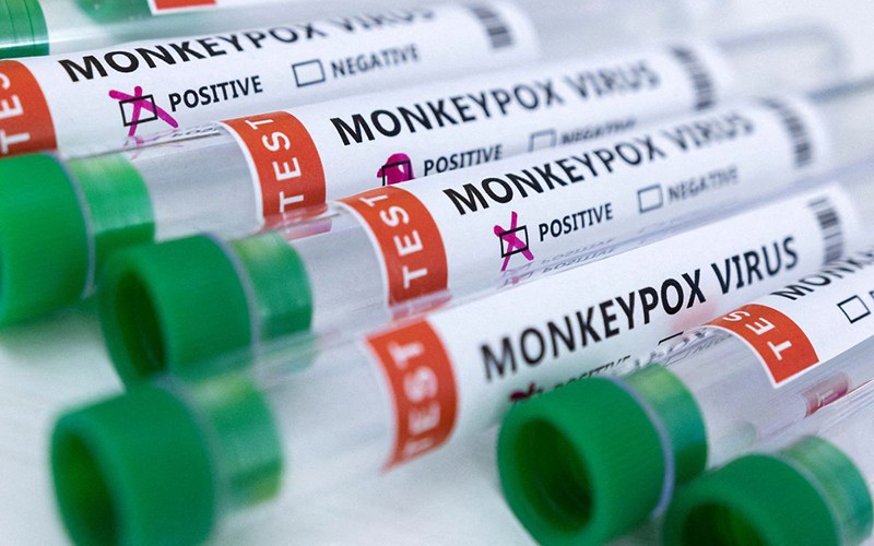 Ống đựng mẫu bệnh phẩm dương tính với virus gây bệnh đậu mùa khỉ. (Ảnh: Reuters)
