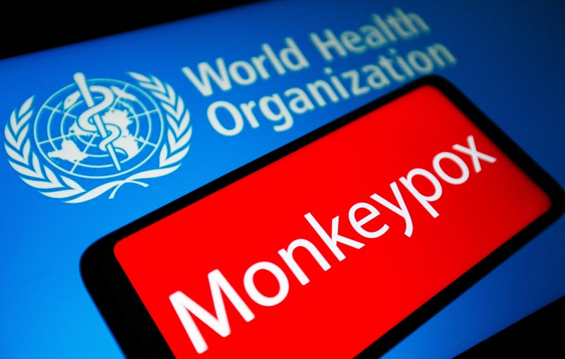 Đến nay, đã có hơn 15 nghìn ca được báo cáo mắc bệnh đậu mùa khỉ ở những nước trước đây không hề phát hiện căn bệnh này. (Ảnh: Getty Images)