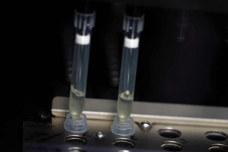 Hai mẫu bệnh phẩm nghi ngờ nhiễm virus đậu mùa khỉ đang trong quá trình xét nghiệm tại phòng thí nghiệm vi sinh, Bệnh viện La Paz, Madrid, Tây Ban Nha, ngày 1/6/2022. (Ảnh: Reuters)