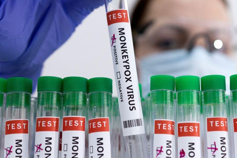 Ống xét nghiệm bệnh đậu mùa khỉ. (Ảnh: Reuters)