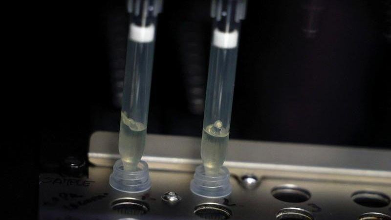 Hai mẫu bệnh phẩm nghi ngờ nhiễm virus đậu mùa khỉ đang trong quá trình xét nghiệm tại phòng thí nghiệm vi sinh, Bệnh viện La Paz, Madrid, Tây Ban Nha, ngày 1/6/2022. (Ảnh: Reuters)